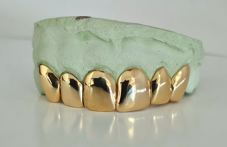 10kt Gold Custom Solid Grillz with Permanent Cuts