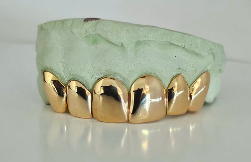 10kt Gold Custom Solid Grillz with Permanent Cuts