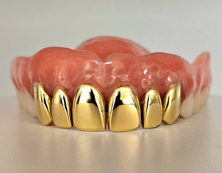 10kt Gold Custom Solid Grillz with Permanent Cuts