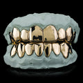 10kt Gold Custom Solid Grillz with Permanent Cuts