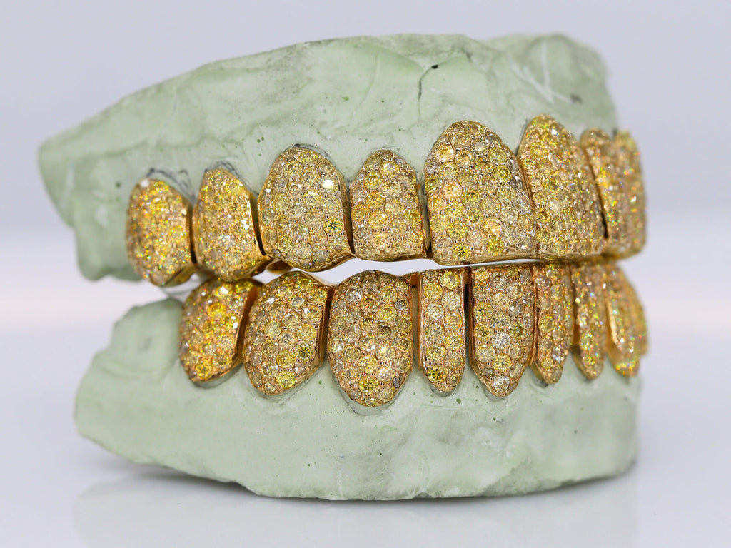 10kt Yellow Gold Permanent Cuts with Moissanites Custom made Grillz
