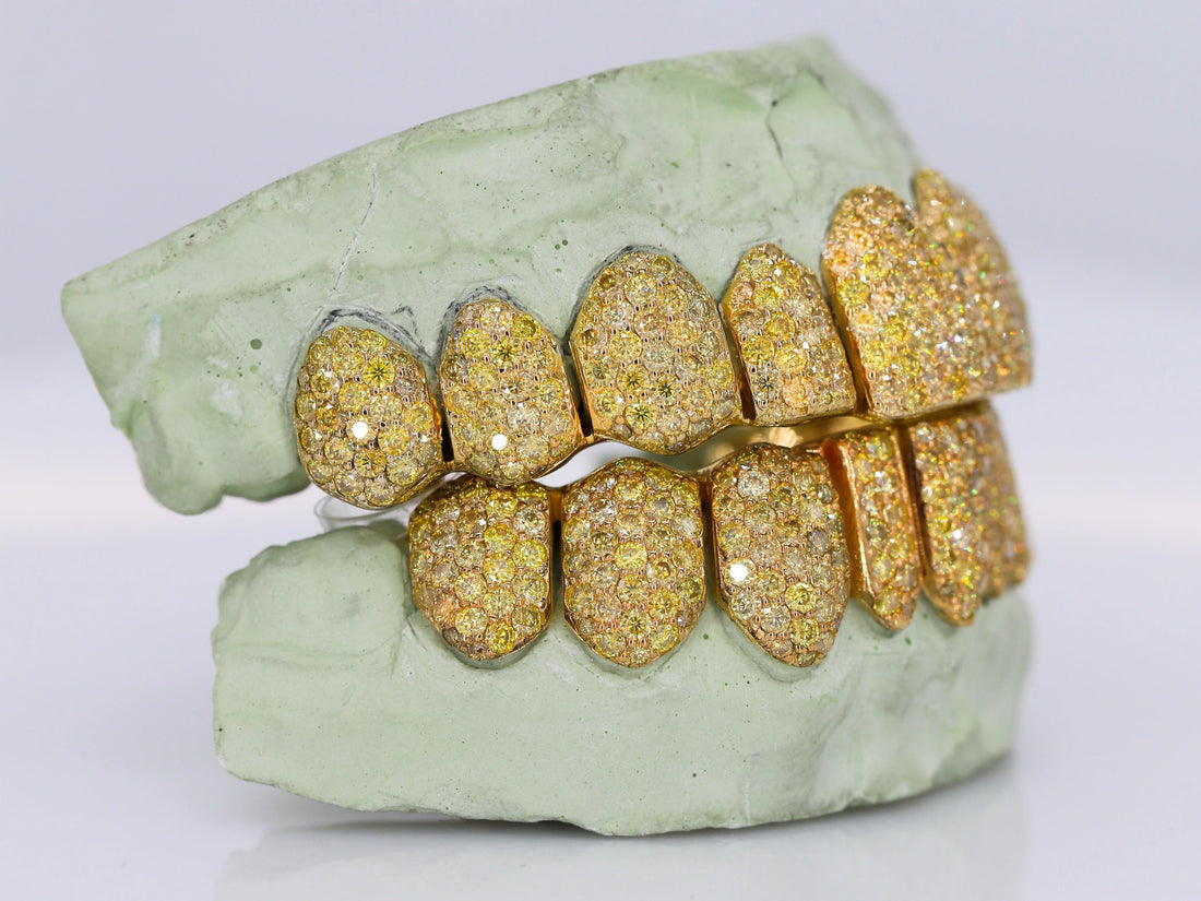 10kt Yellow Gold Permanent Cuts with Moissanites Custom made Grillz