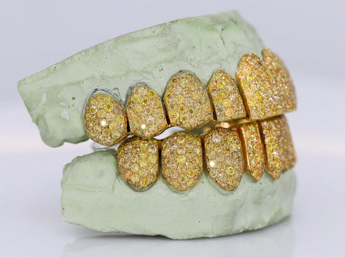 10kt Yellow Gold Permanent Cuts with Moissanites Custom made Grillz