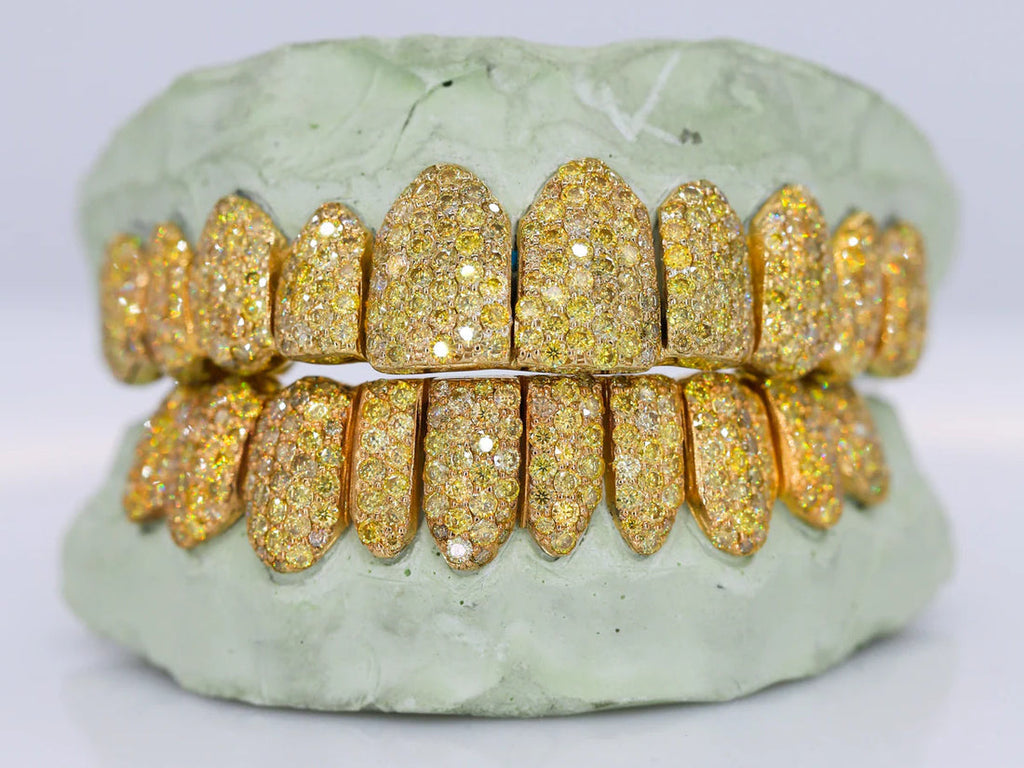 10kt Yellow Gold Permanent Cuts with Moissanites Custom made Grillz